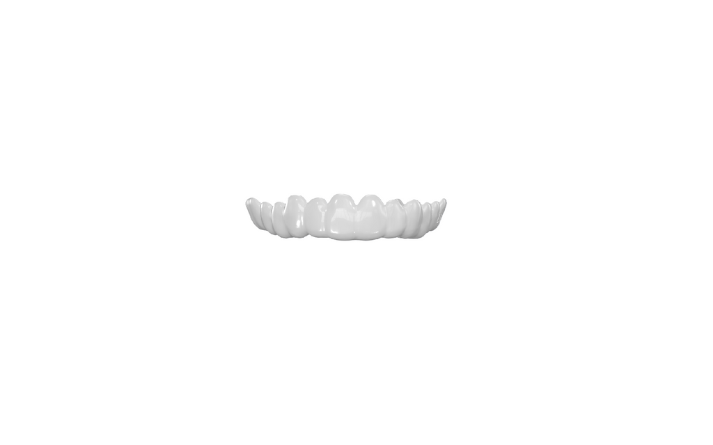 Sports Mouthguard (Lightweight)